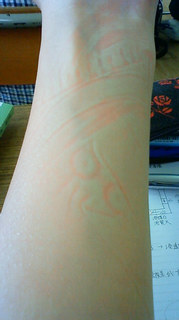 ��������r